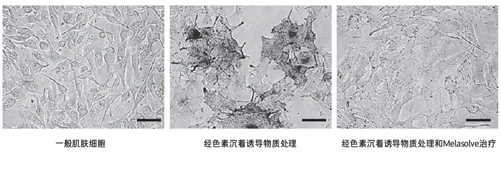 Melasolve：为安全美白献力